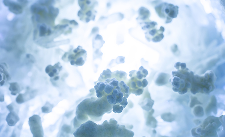 Breast Cancer Cell Lines