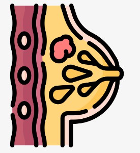 Triple-Negative Breast Cancer (TNBC)