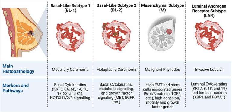 Fig.1 Main histopathology, markers, and signalling pathways of medullary breast carcinoma. (Mahmoud R., et al. 2022)