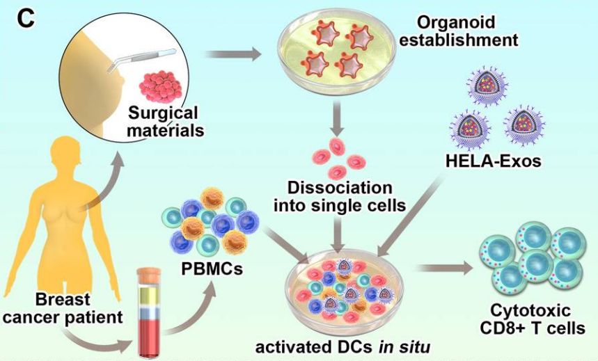 HELA-Exos activated DCs in situ in the breast cancer patient PBMC-autologous tumor organoid coculture system.