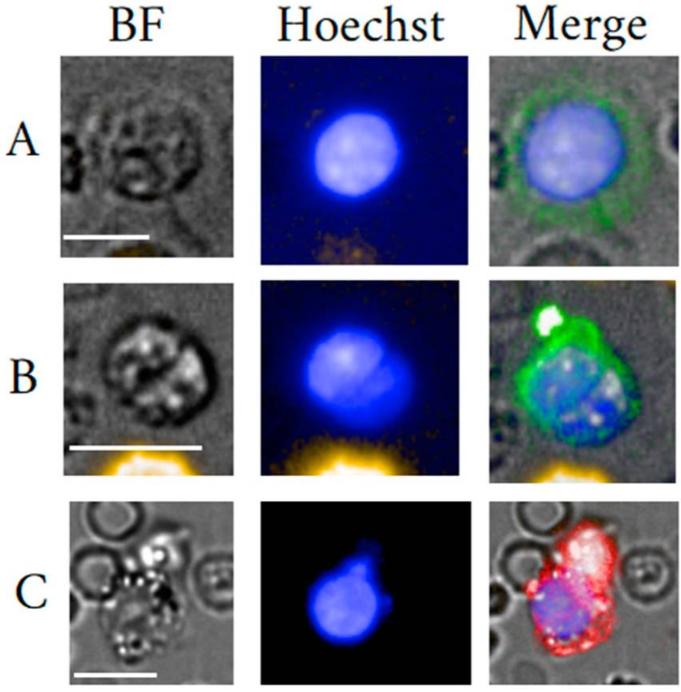 Introduction of Rare Cell