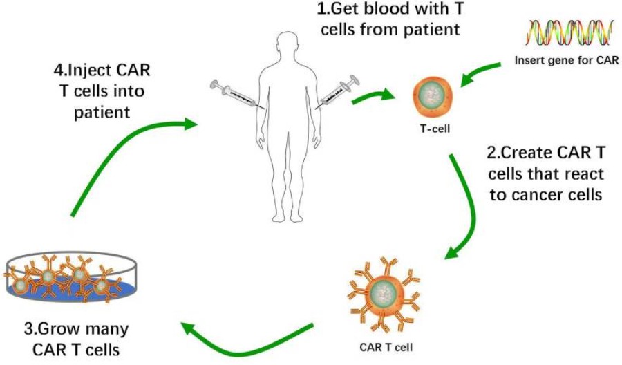 Production process of CAR-T cells.