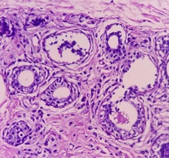 Images of breast tissue.