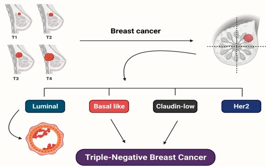 Molecular subtypes of breast cancer and types of triple-negative breast cancer.